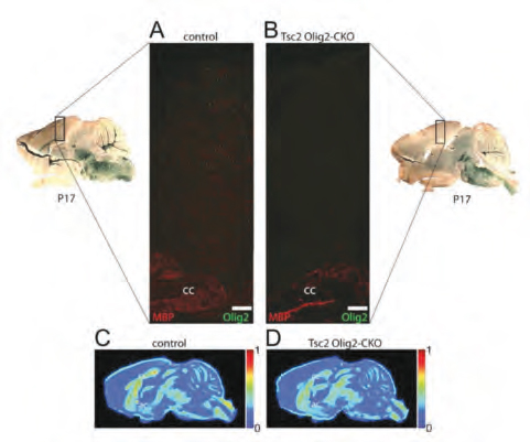 Hypomyelination resulting from loss of the Tsc2 gene in oligodendrocytes